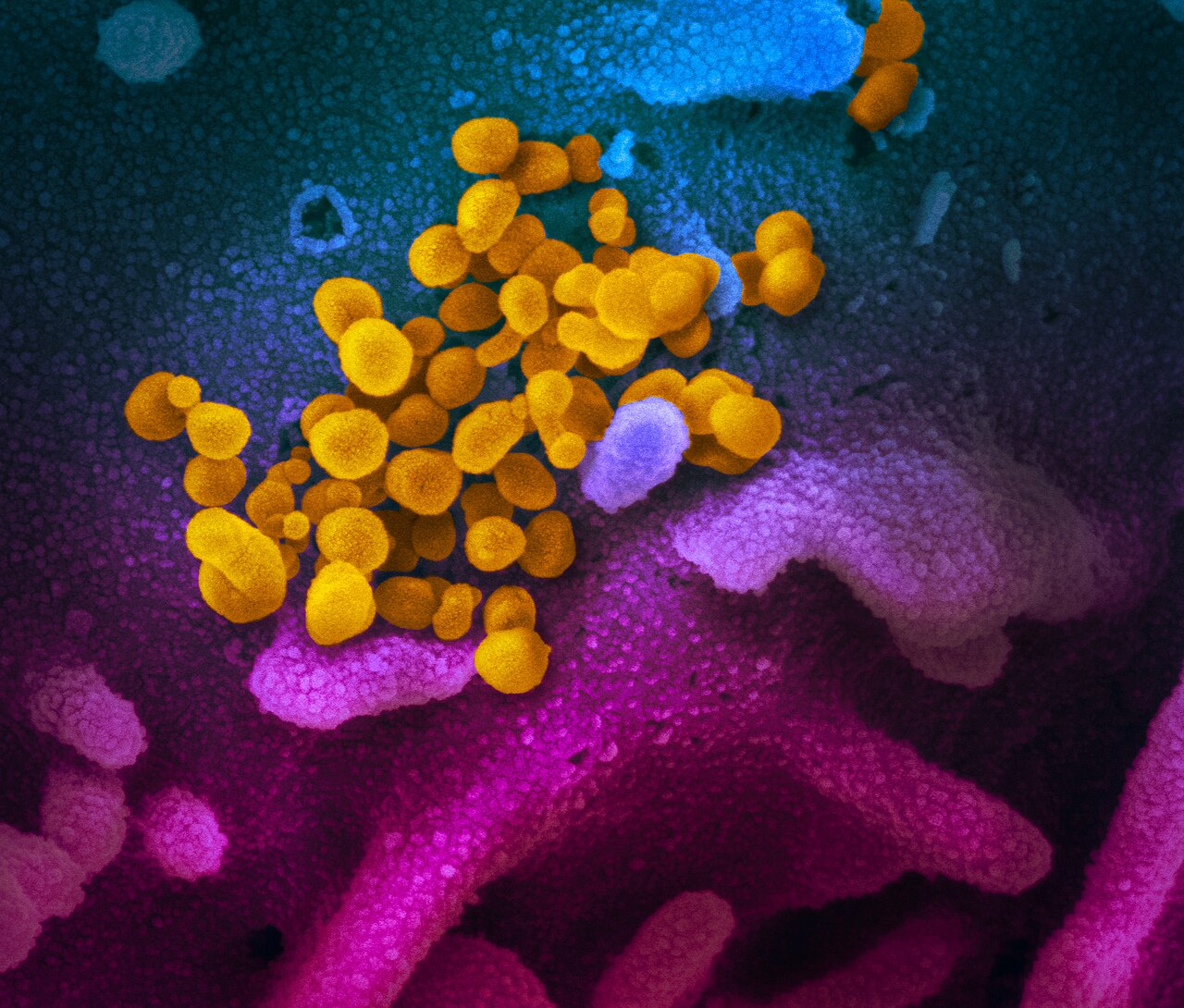 "Novel Coronavirus SARS-CoV-2: