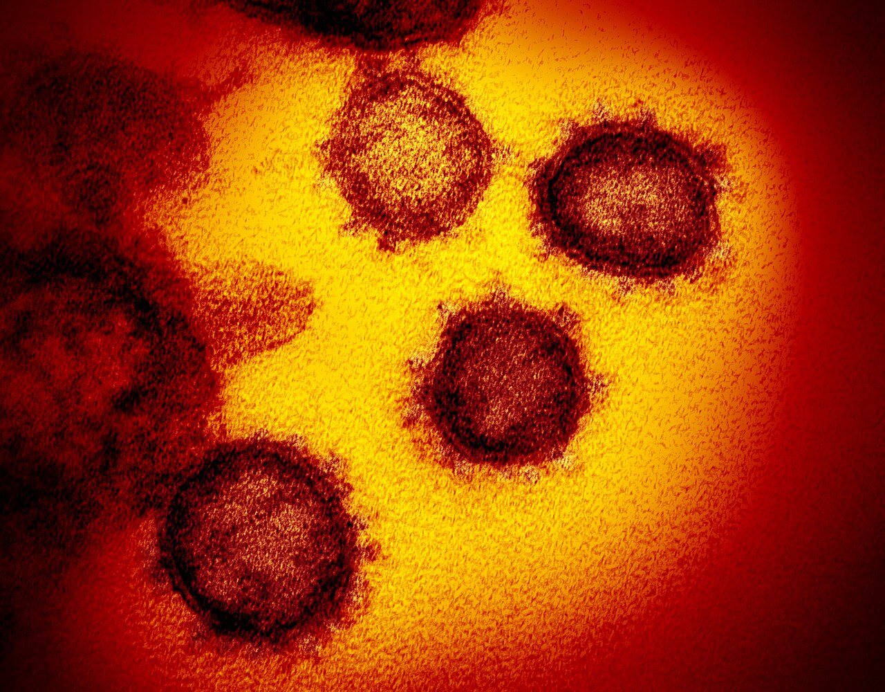"Novel Coronavirus SARS-CoV-2