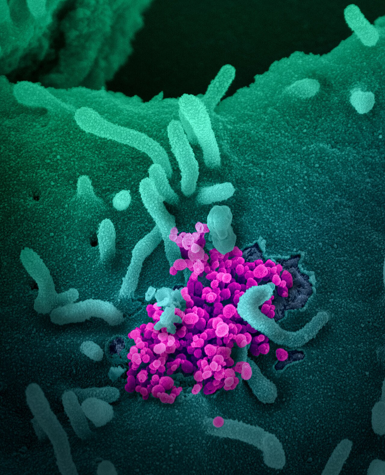 This scanning electron microscope image shows SARS-CoV-2 (round magenta objects) emerging from the surface of cells cultured in the lab. SARS-CoV-2, a