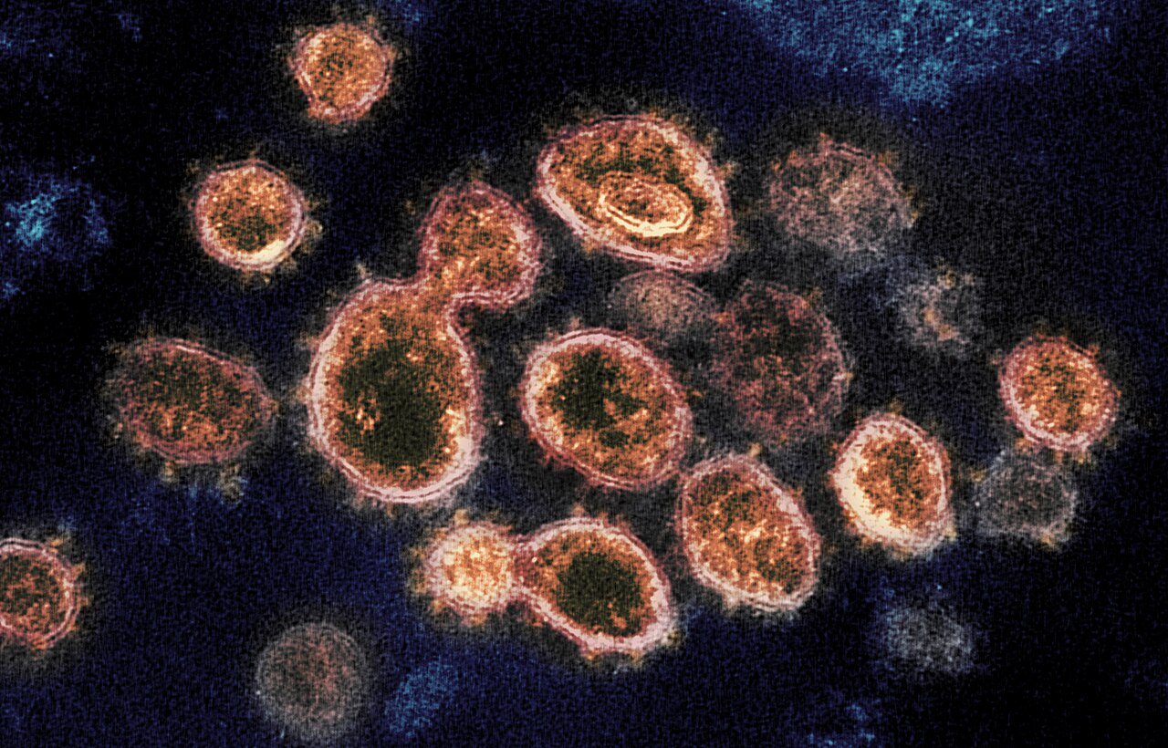This transmission electron microscope image shows SARS-CoV-2, the virus that causes COVID-19, isolated from a patient in the U.S. Virus particles are