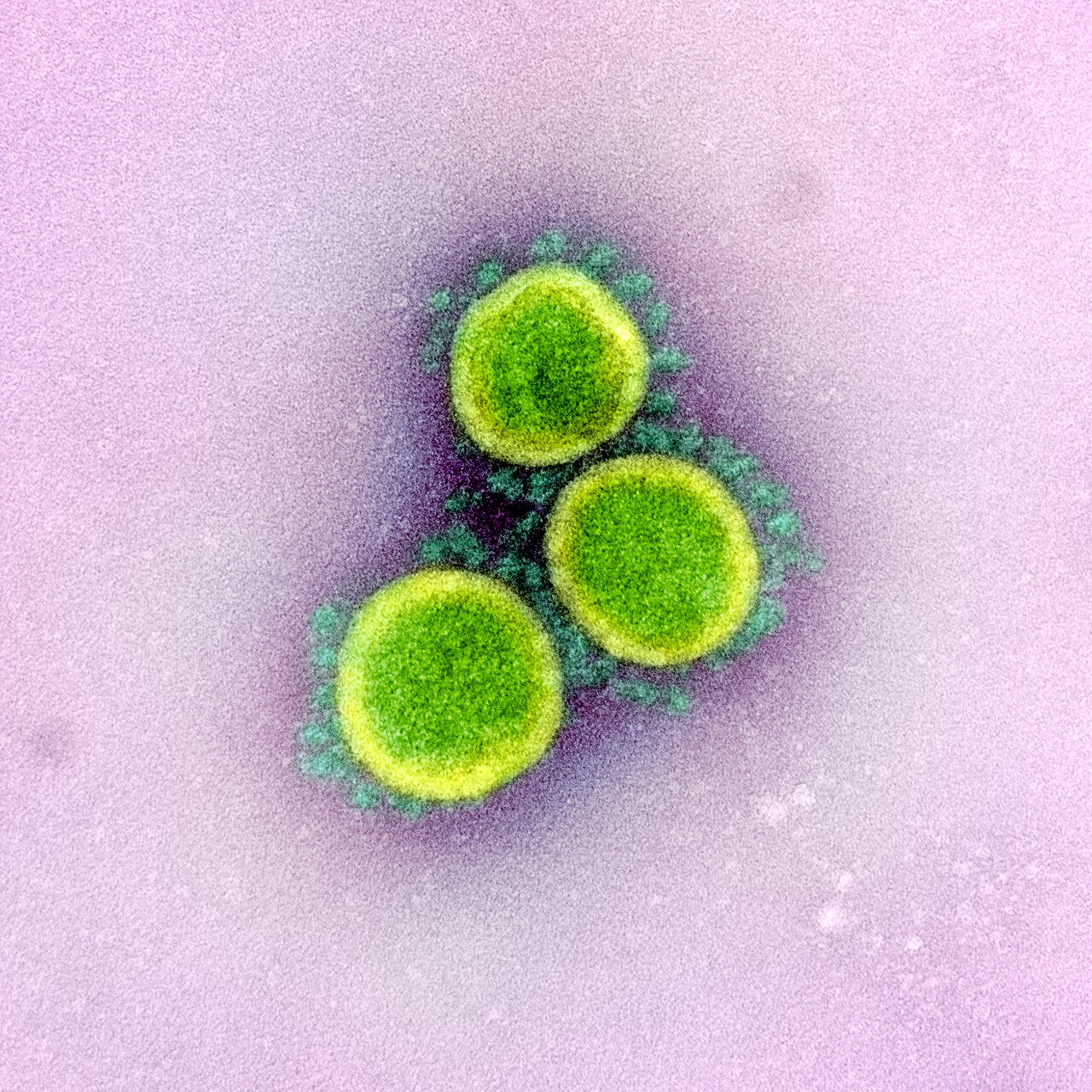 Transmission electron micrograph of SARS-CoV-2 virus particles, isolated from a patient. Image captured and color-enhanced at the NIAID Integrated Res